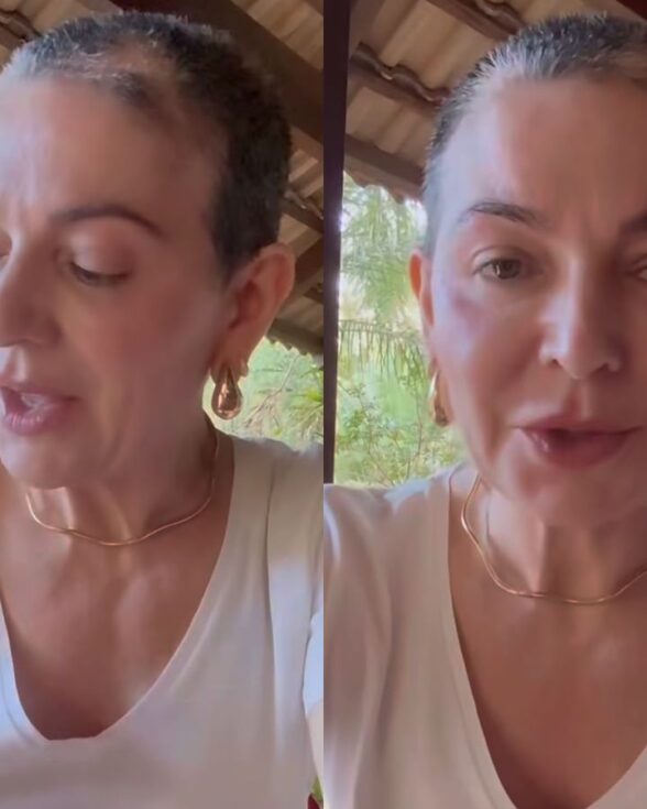 Após melhora, mãe de Lucas Lucco lamenta recaída de alopecia severa: “Mais triste”